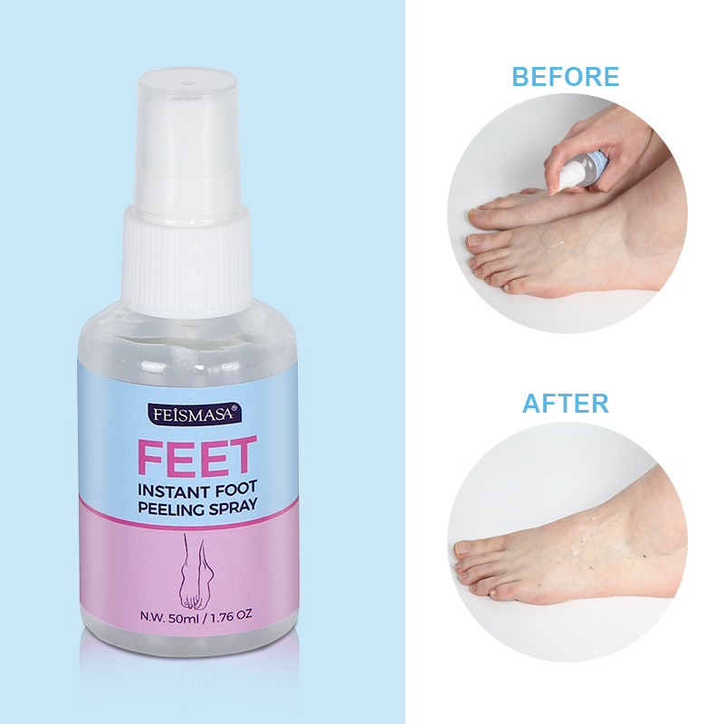 Softening Instant Exfoliating Dead Skin Foot Care Spray Anti Cracking Foot Masking Moisturizing